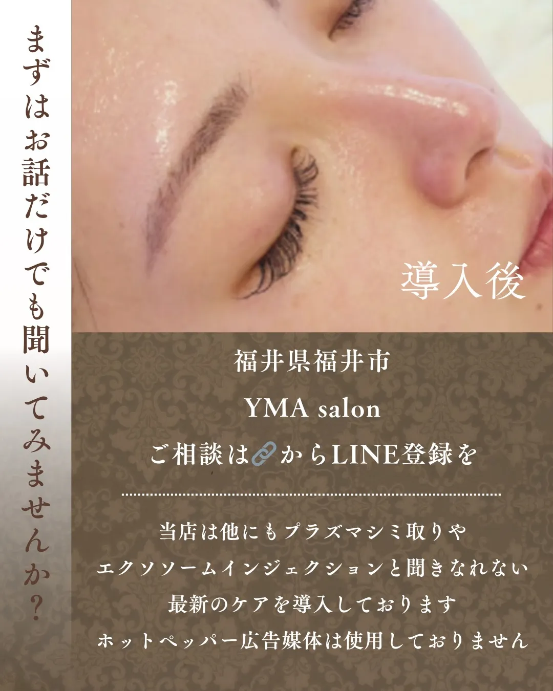 メソスキンカラー、はじめます。