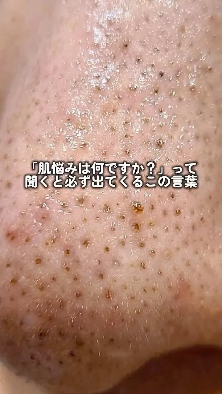 毛穴・皮脂・くすみ。